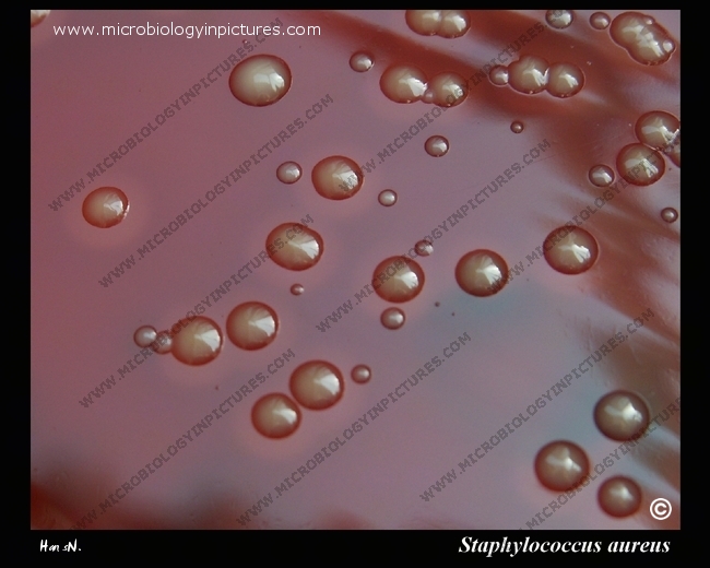 s.aureus beta-hemolysis